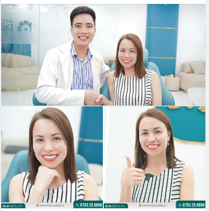 "RẤT HÀI LÒNG" và "ƯNG Ý" sau thẩm mỹ 20 răng sứ Emax tại Delia