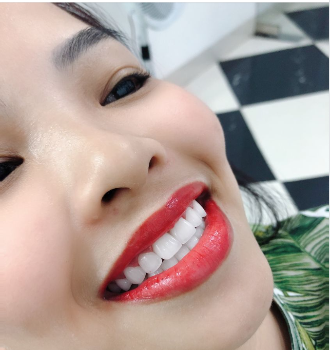 SÁNG SUỐT LỰA CHỌN CƠ SỞ NHA KHOA UY TÍN LÀM RĂNG THẨM MỸ