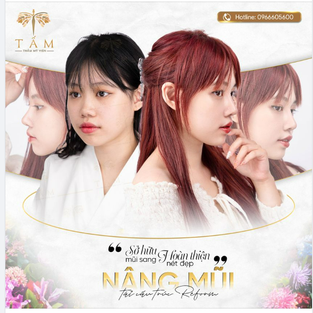 SỞ HỮU MŨI SANG - HOÀN THIỆN NÉT ĐẸP