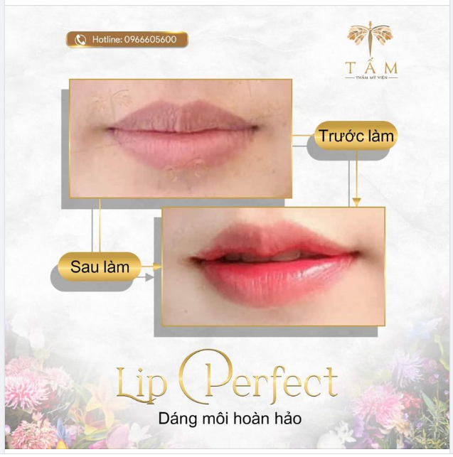 Sở hữu ngay đôi môi xinh xắn, chuẩn dáng nàng thơ cùng LIPS PERFECT