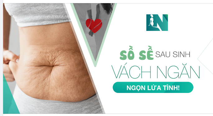 SỒ SỀ SAU SINH – VÁCH NGĂN NGỌN LỬA TÌNH!