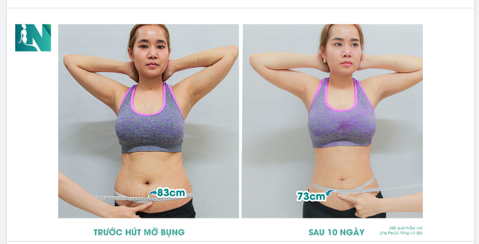 SỐNG TRỌN THANH XUÂN, EM CHỌN ĐẸP SỚM HƠN!