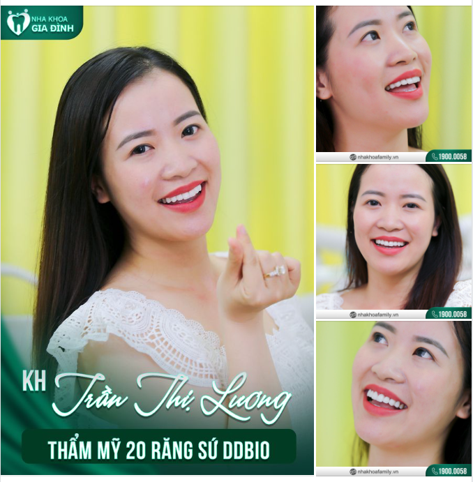 Sự hài hòa này là yếu tố quan trọng nhất của cái đẹp và nó được tạo bởi một yêu cầu chuyên môn cực cao, một con mắt thẩm mỹ của người Bác sĩ có tâm và tay nghề khéo léo.