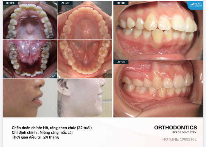 Suy cho cùng, mọi mục tiêu dù nhỏ bé hay to lớn, bạn cũng sẽ có tầm tay, chỉ cần không từ bỏ nỗ lực