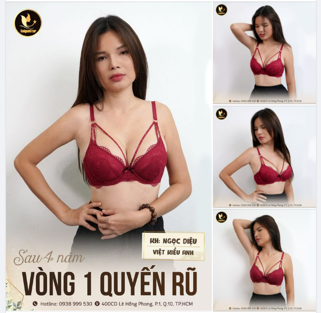 TÁI KHÁM SAU 4 NĂM NÂNG NGỰC KH. NGỌC DIỆU - VIỆT KIỀU ANH