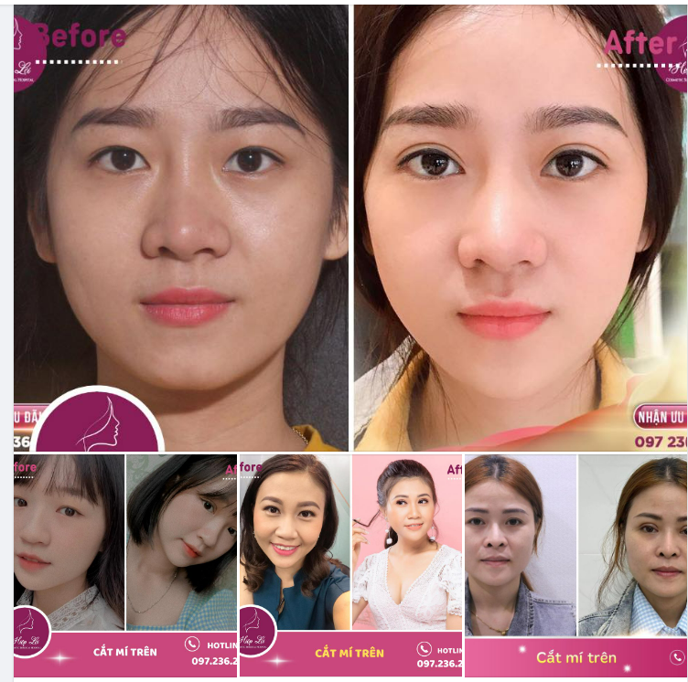 TẠM BIỆT SỤP MÍ - MẮT TO TRÒN NHƯ Ý