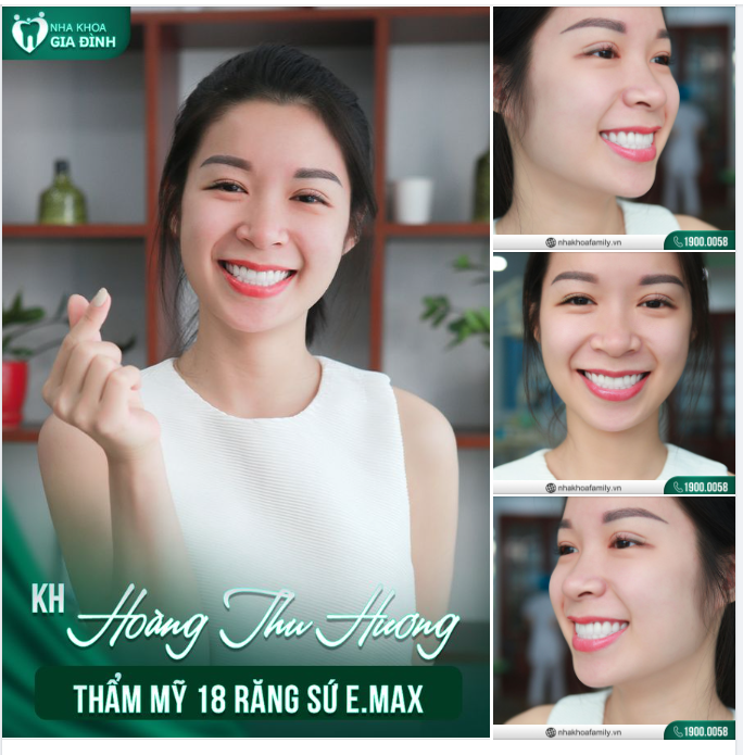 Tân trang lại hàm răng - Một cách đơn giản nhất giúp bạn có được cho bản thân nụ cười hoàn mỹ.