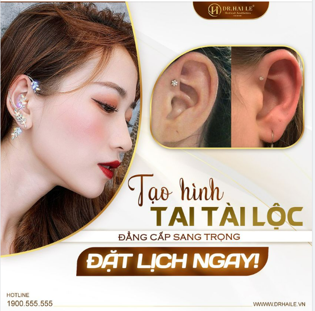 TẠO HÌNH TAI TÀI LỘC MANG ĐẾN VẺ ĐẸP ĐẲNG CẤP, PHÚ QUÝ