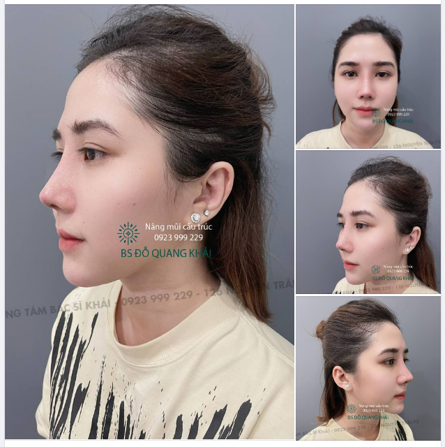 THAM KHẢO NGAY DÁNG MŨI CẤU TRÚC ĐẦU MŨI BAY PHONG THỦY