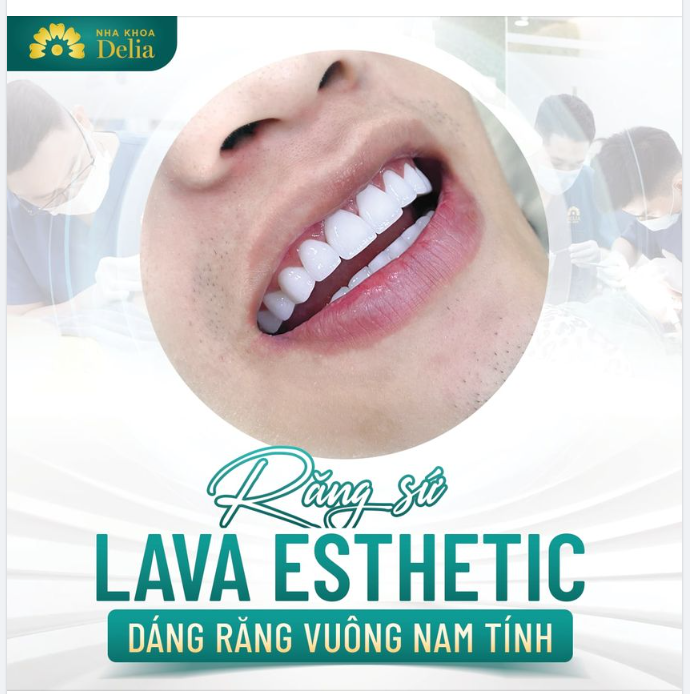 Thẩm mỹ răng sứ Lava Esthetic - Tăng phần nam tính đẹp tựa nam thần