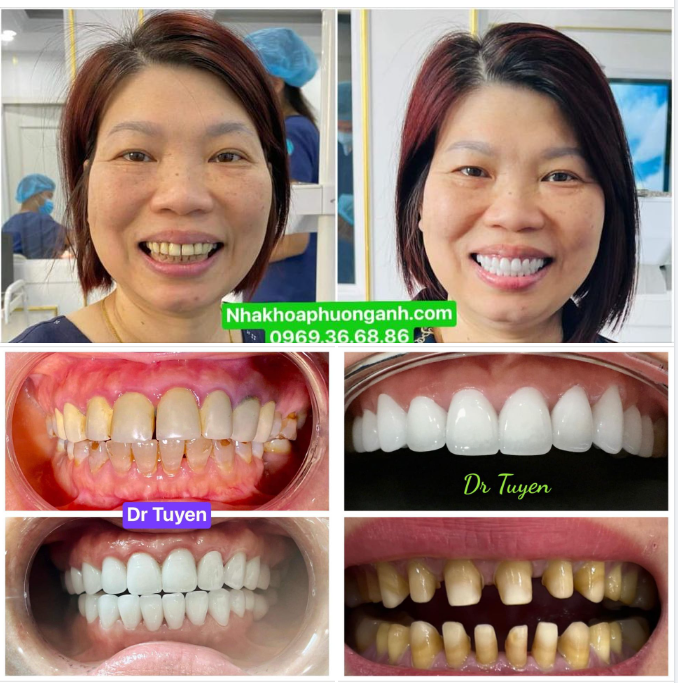 THĂM QUÊ HƯƠNG & TÌM LẠI NỤ CƯỜI !