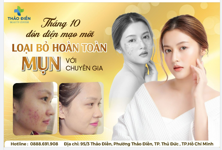 THÁNG 10 ĐÓN DIỆN MẠO MỚI - HẾT MỤN SẠCH THÂM SẴN SÀNG TOẢ SÁNG