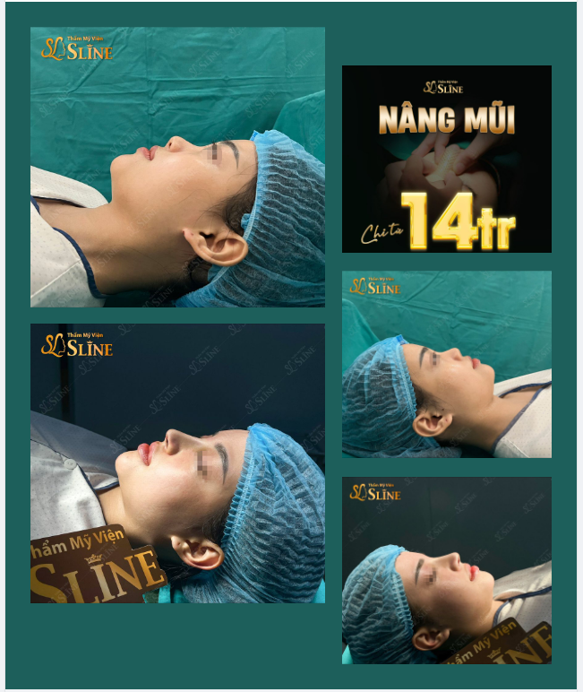 THÁNG VÀNG LÀM ĐẸP