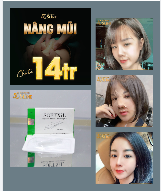 THÁNG VÀNG NÂNG MŨI