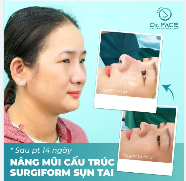 THAY ĐỔI ĐẦU MŨI ĐỔI LUÔN NÉT DỮ HIỀN