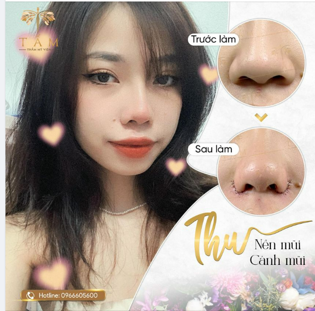Thay đổi nhỏ nhưng đem đến kết quả cực kỳ khả quan!