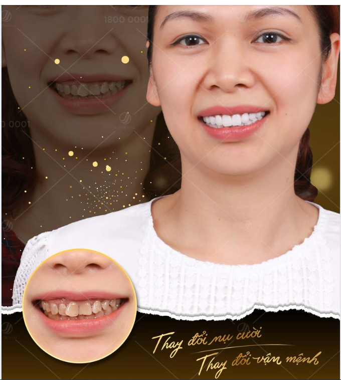 THAY ĐỔI NỤ CƯỜI ĐÓN NHẬN NIỀM VUI