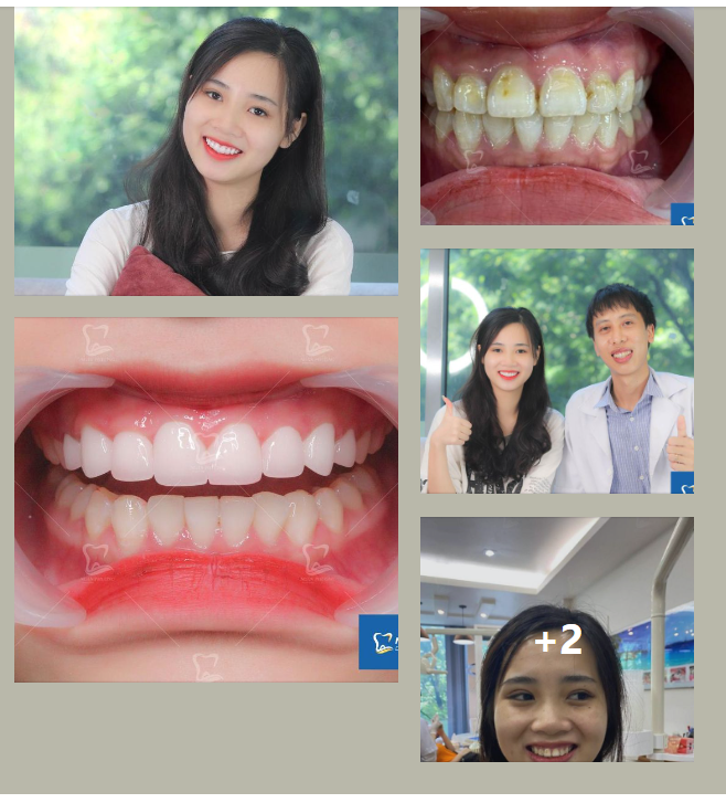 THAY ĐỔI THẦN TỐC NỤ CƯỜI CHO NỮ STREAMER
