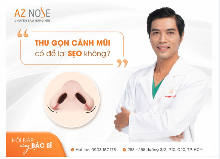 Thu gọn cánh mũi có để lại s.ẹo như lời đồn