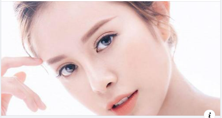 Tiêm filler cằm là giải pháp nhanh chóng, hiệu quả để có được dáng cằm đẹp thon gọn chuẩn V line.