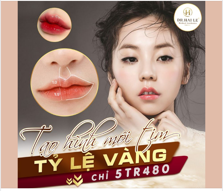 ​​​​​​​ Tiêm Filler Môi - Tạo hình môi trái tim gợi cảm tại Dr.Hải Lê