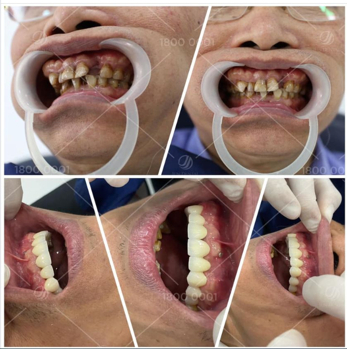 Trăm lời quảng cáo cũng không bằng một nụ cười rạng rỡ hài lòng của khách hàng