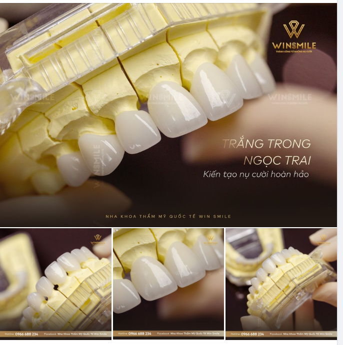 TRẮNG TRONG NGỌC TRAI - KIẾN TẠO NỤ CƯỜI HOÀN HẢO