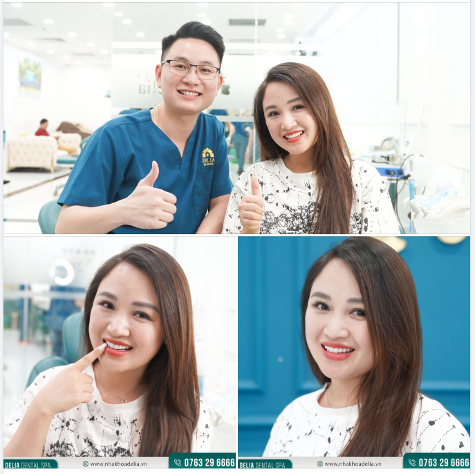 Trở thành BEST - SALES bất động sản sau thẩm mỹ răng sứ tại Delia