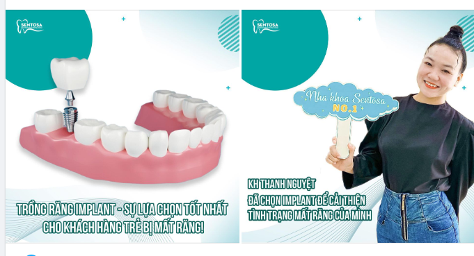 TRỒNG RĂNG IMPLANT - GIẢI PHÁP TỐT NHẤT CHO KHÁCH HÀNG TRẺ BỊ MẤT RĂNG !