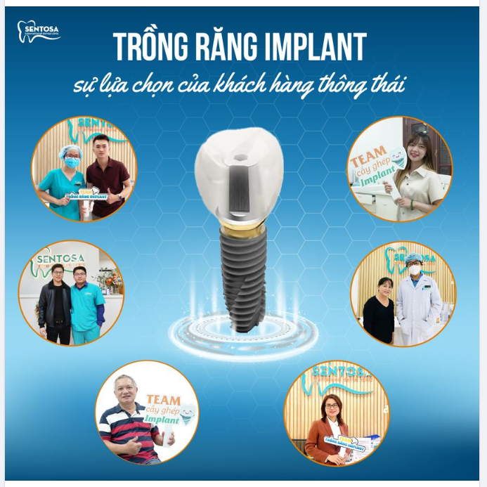 TRỒNG RĂNG IMPLANT - SỰ LỰA CHỌN CỦA KHÁCH HÀNG THÔNG THÁI
