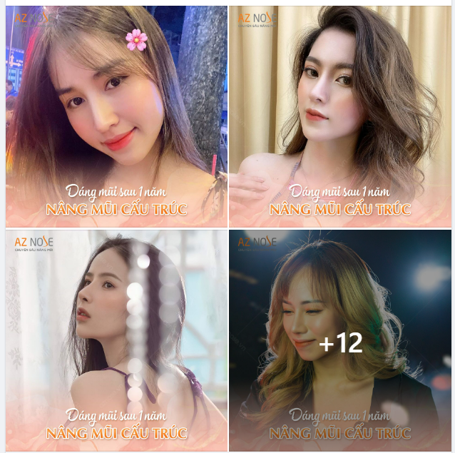 TỰ TIN KHOE DÁNG VỚI MŨI 1 NĂM TUỔI