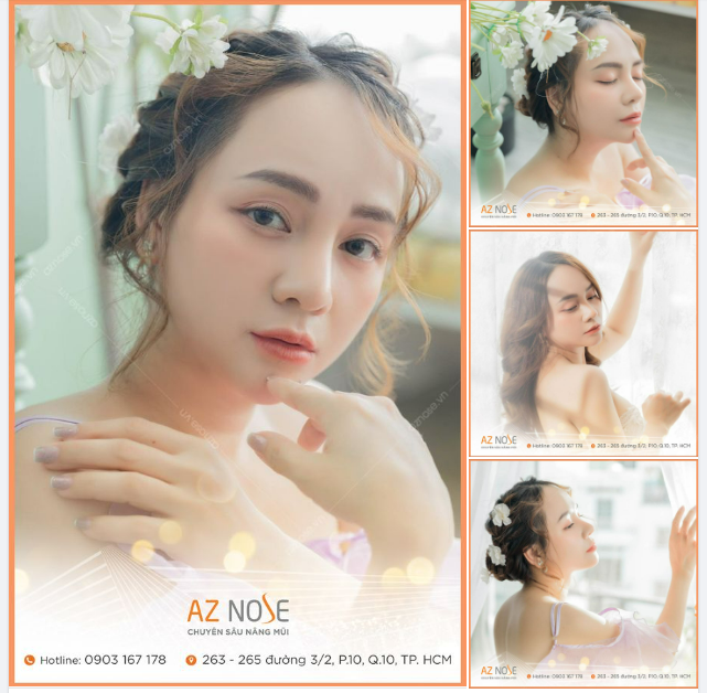 Tự tin lưu giữ thanh xuân sau 5 tháng nâng mũi