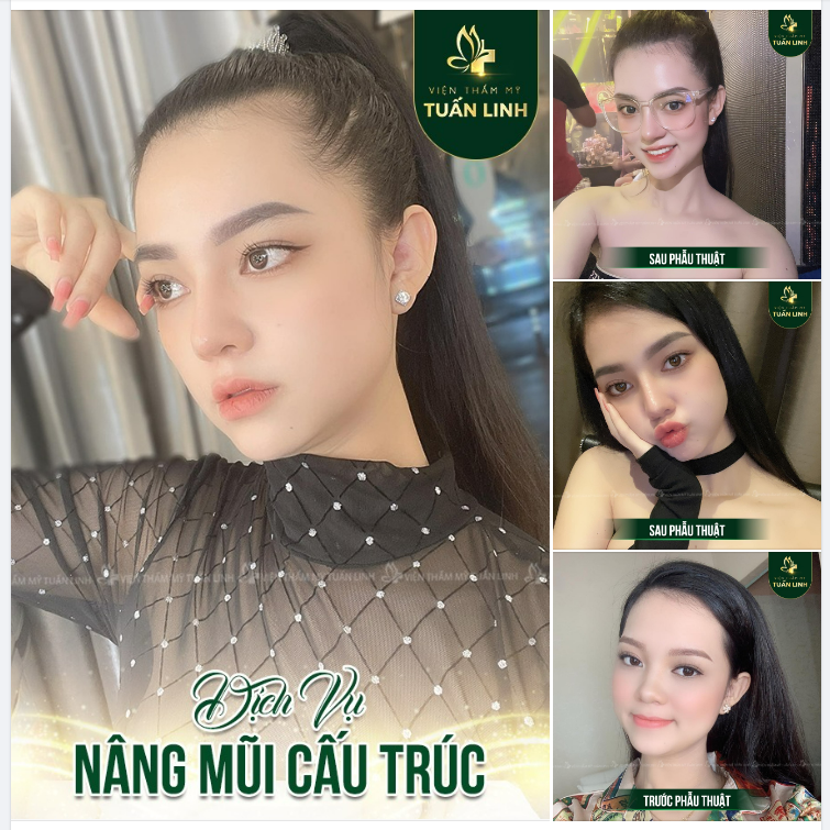 U òa mũi xinh thế này ,tội gì không nâng cả nhà ơi