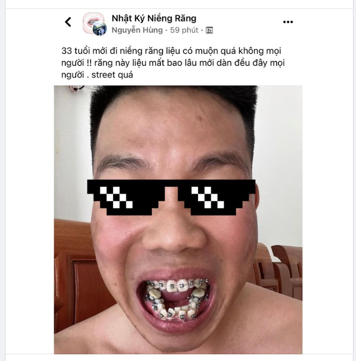 U.30 NIỀNG RĂNG ĐƯỢC KHÔNG ?