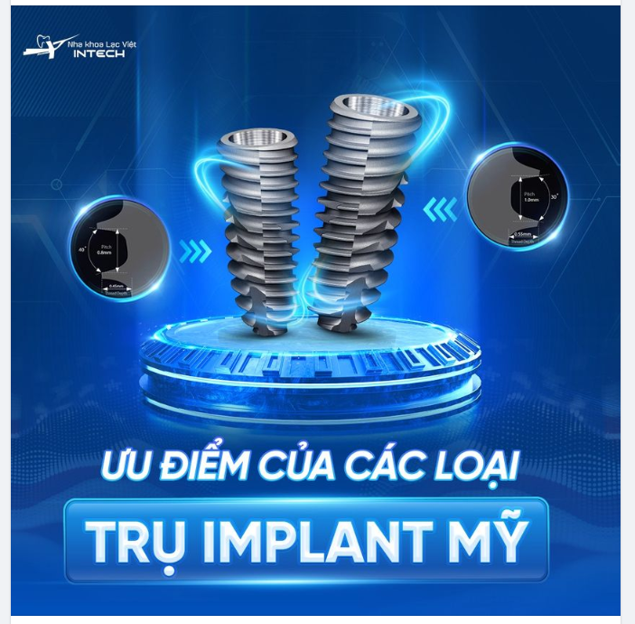 ƯU ĐIỂM CỦA CÁC DÒNG TRỤ IMPLANT MỸ