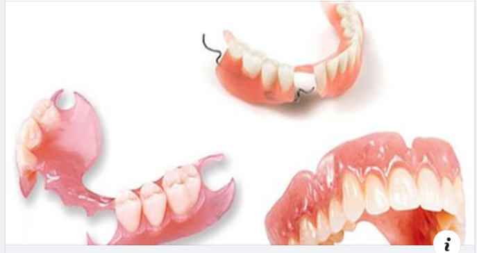 Ưu Nhược Điểm Của Hàm Giả Tháo Lắp