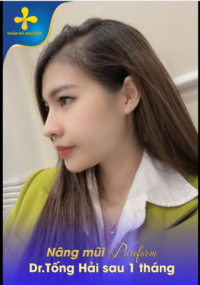 Vẫn là góc nghiêng, nhưng sao nay lạ quá️