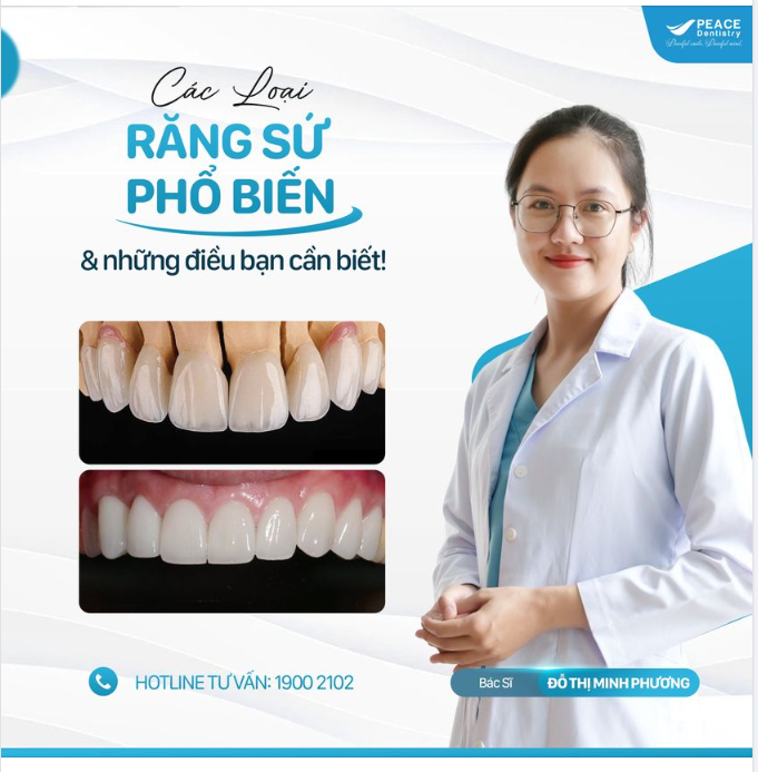 VẬT LIỆU SỨ TRONG PHỤC HÌNH THẨM MỸ – HIỂU ĐÚNG ĐỂ CHỌN ĐÚNG