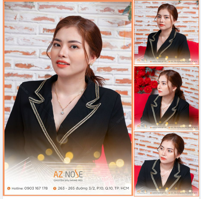 Vẻ đẹp sang trọng của nàng CEO sau 1 năm tái tạo dáng mũi