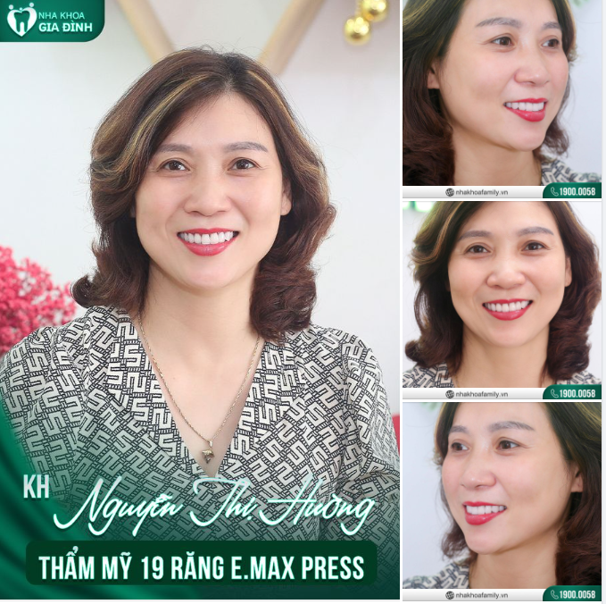 Vẻ đẹp tâm hồn cần thời gian để lan tỏa. Vẻ đẹp dung nhan, lạ thay, có quyền lực ngay tức thì".