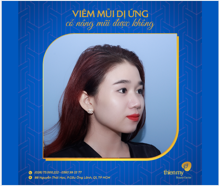 Viêm mũi dị ứng có nâng mũi được không