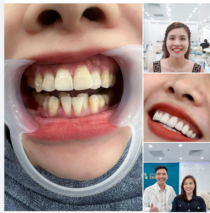 Với sự thay đổi ngoạn mục của chị chủ shop dưới đây, cả nhà chấm bao nhiêu điểm cho bác sĩ Dũng của Delia?