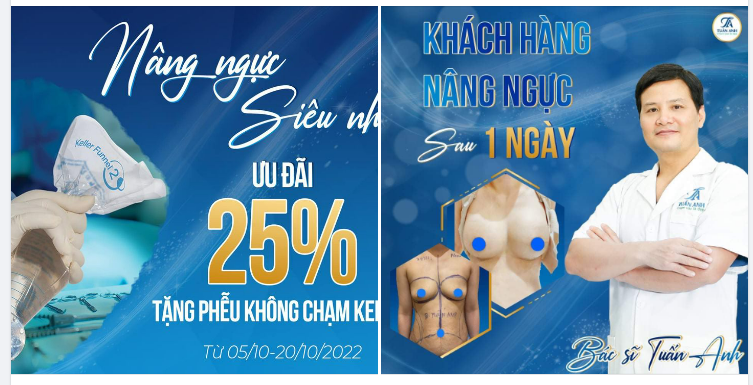 Vòng 1 hoàn hảo hơn với kỹ thuật NÂNG NGỰC KHÔNG CHẠM