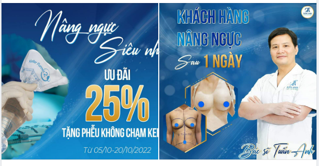 Vòng 1 hoàn hảo hơn với kỹ thuật NÂNG NGỰC KHÔNG CHẠM