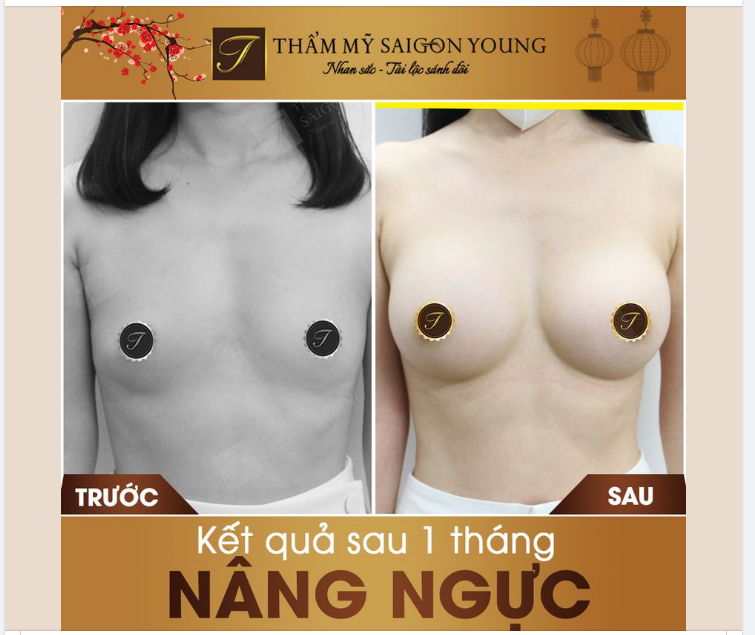 VÒNG 1 SAU 1 THÁNG NÂNG CẤP