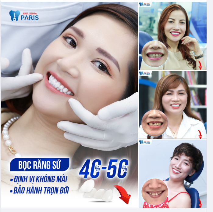 Hết Răng Nhiễm Màu, Tự Tin Trẻ Ra 10 tuổi