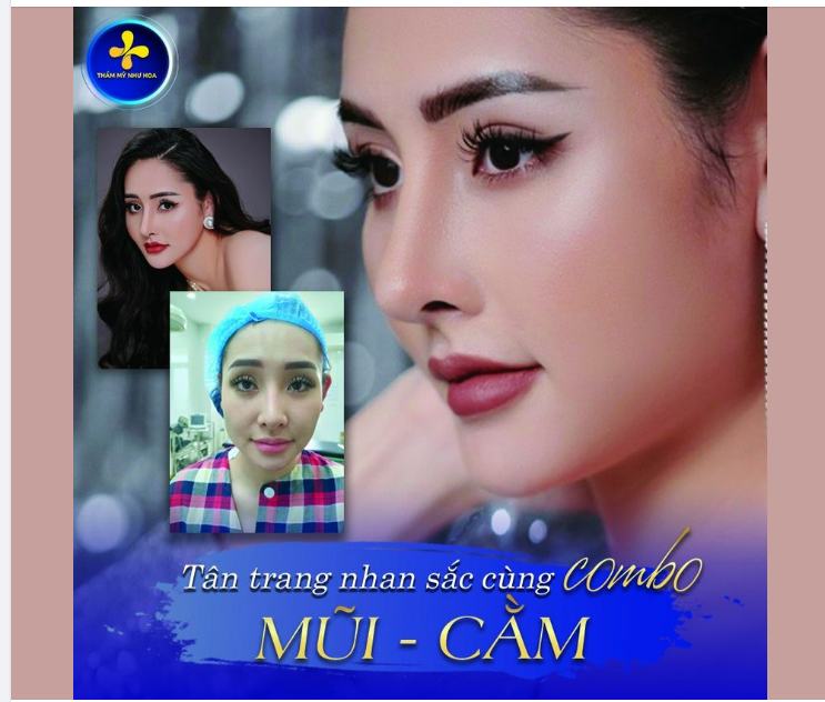 “Combo hoàn hảo” Nâng mũi + Độn cằm đã thay đổi hoàn toàn diện mạo lẫn thần thái của khách hàng. Chỉ cần một thay đổi nhỏ trên khuộc mặt, bạn đã có thể thay đổi nhan sắc hoàn toàn.