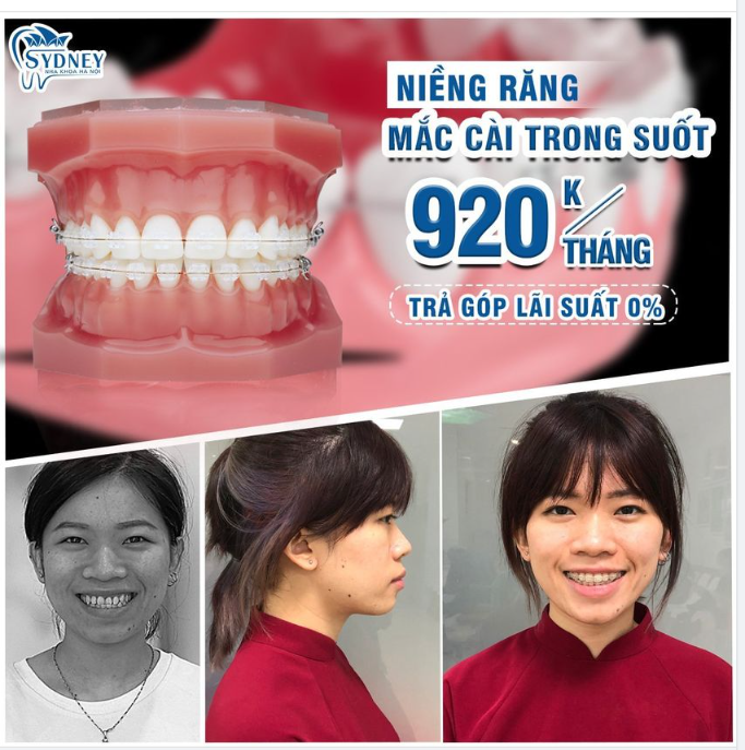 Còn chần chừ gì không tìm ngay lại nụ cười xinh!