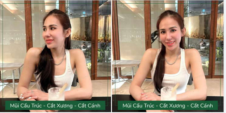 Dù ai có cố tìm góc nào để dìm em đi chăng nữa thì chiếc mũi cấu trúc + cắt cánh + cắt xương tuyệt vời này vẫn mãi khiến khuôn mặt em tỏa sáng đấy nhé