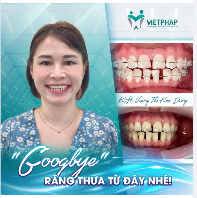 “GOODBYE” RĂNG THƯA TỪ ĐÂY BẠN NHÉ!